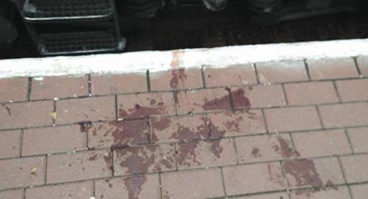 На вокзале в Одессе мужчине поезд отрезал ноги