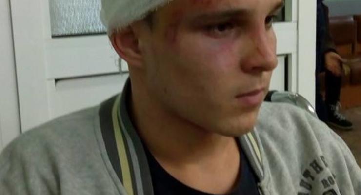 В Глевахе подростки ограбили и проломили череп сыну чиновницы