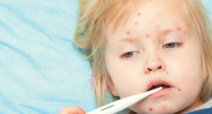 Необъявленная эпидемия: вспышки инфекционных заболеваний в Украине