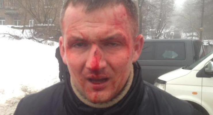 В центре Киева избили депутата-свободовца Левченко