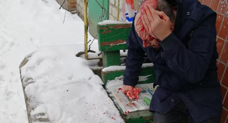 На Печерске мужчину ранили и ограбили прямо у пункта полиции