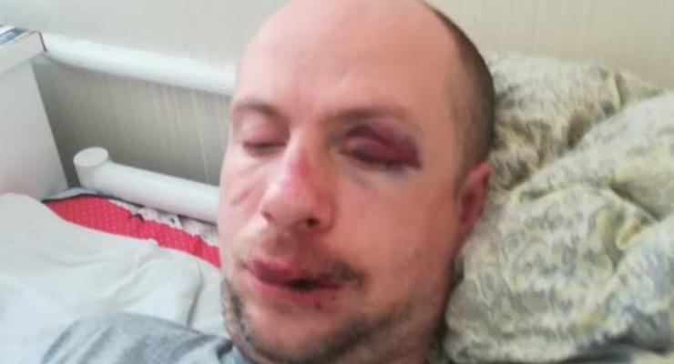 Под Киевом жестоко избили и ограбили инвалида-ветерана АТО