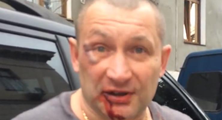 "Опасно быть украинцем": в Крыму жестоко избили мужчину