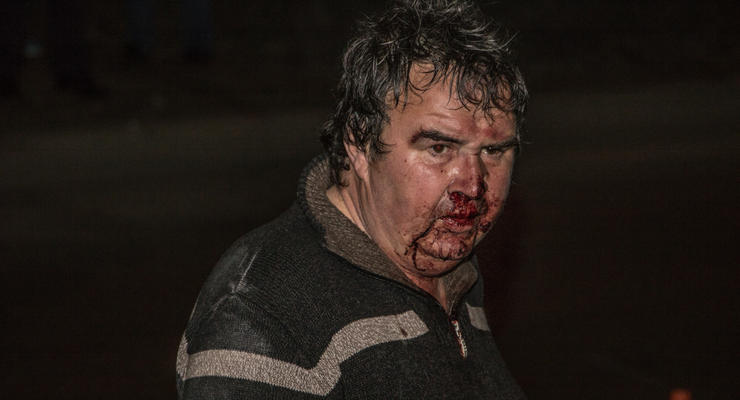 В Киеве пьяный таксист устроил ДТП с пострадавшим