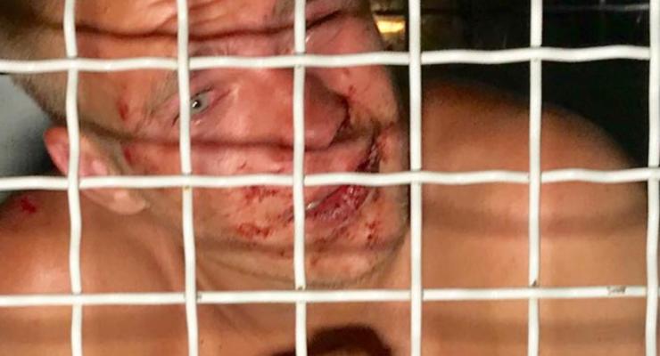 На Подоле пьяные напали на полицейского, травмировали руку