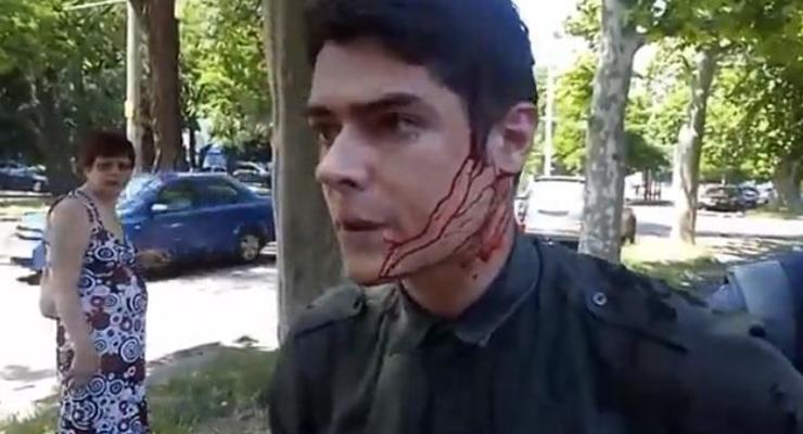 В Одессе ранили ножом лидера местного Автомайдана