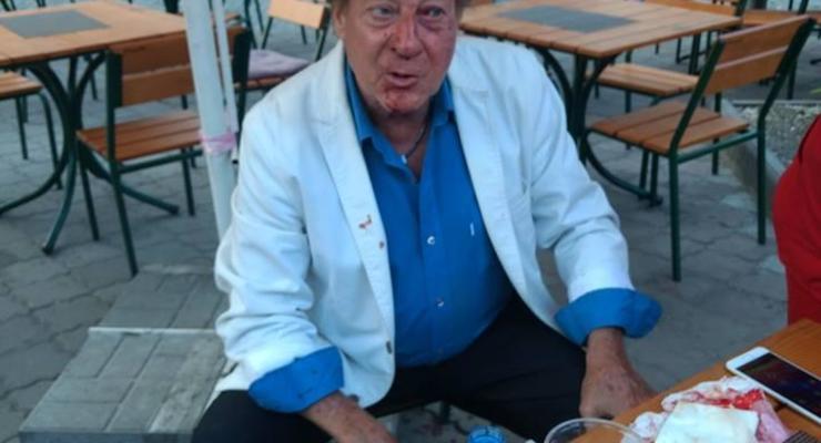 В Одессе избили 71-летнего американского певца