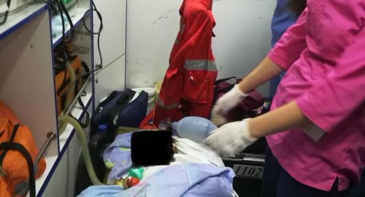 В Харьковской области 5-летний ребенок упал в костер