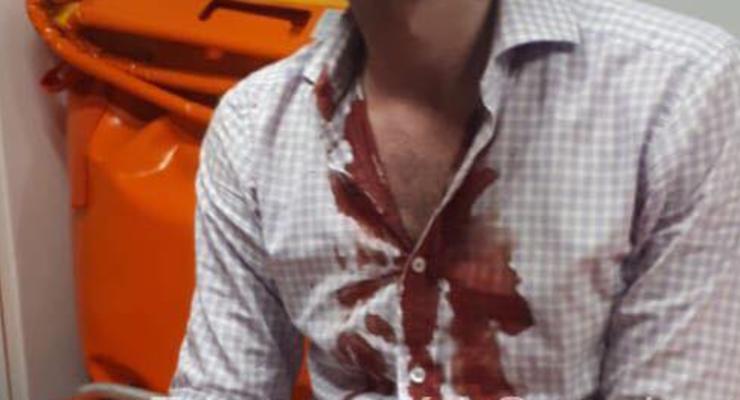 В Киеве неадекватный мужчина напал на парня с саблей