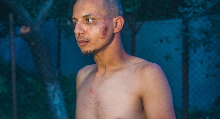 В Киеве пьяный египтянин разбил три авто и врезался в дерево