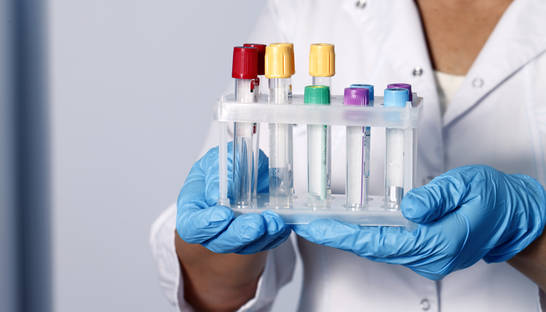 Украинцы смогут бесплатно сдавать анализы - Гройсман