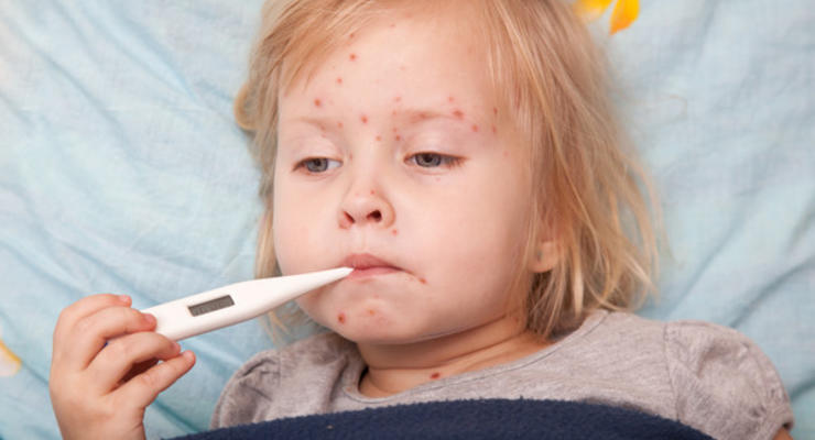 В Прикарпатье корью заболели 53 ребенка: вакцины хранили с нарушением