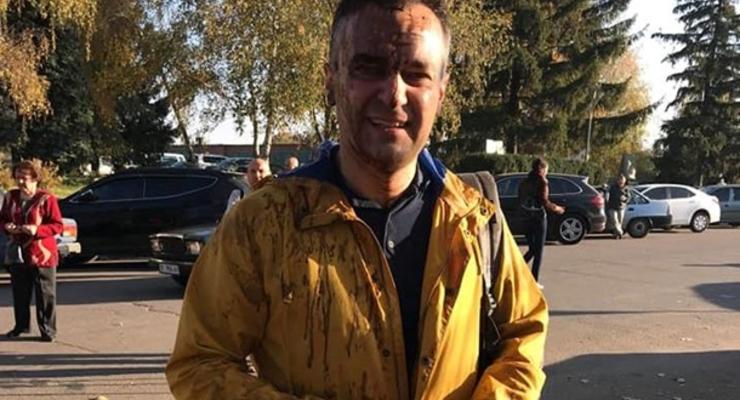 Полиция установила, кто облил нечистотами журналиста Гнапа