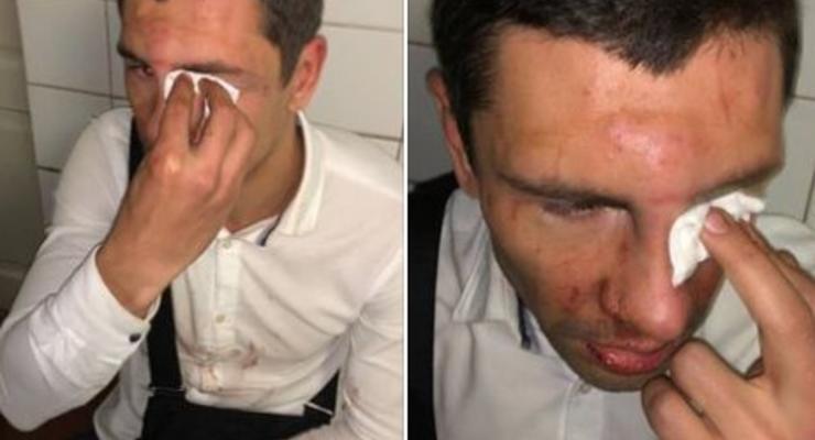 В Киеве избили лидера "молодых ляшковцев": сломан нос и челюсть