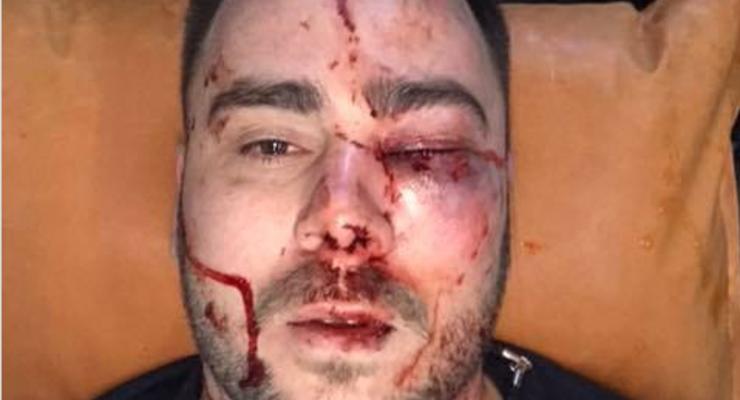 В Запорожье прострелили ногу и избили активиста