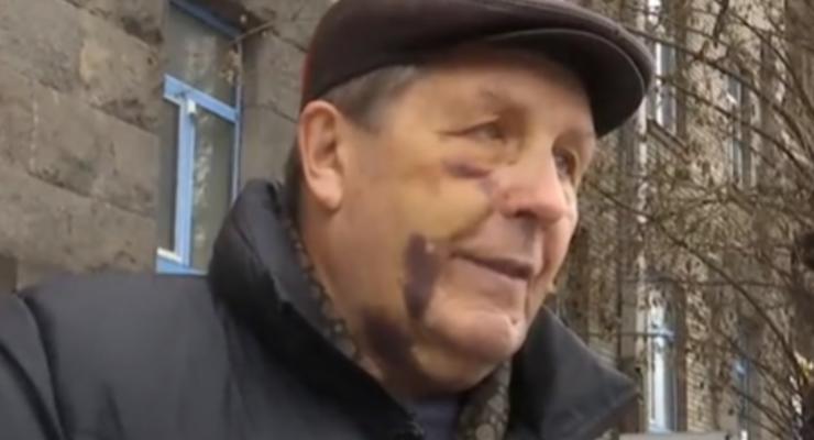 Перепутали: В Киеве полицейские избили авиаконструктора завода Антонов