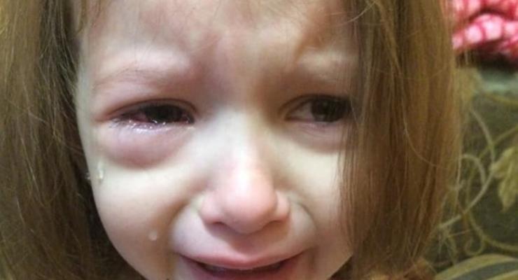 В детсаду Днепра девочку ударили карандашом в глаз