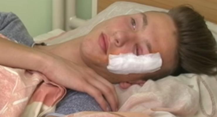 В Кропивницком мужчина ранил топором школьника