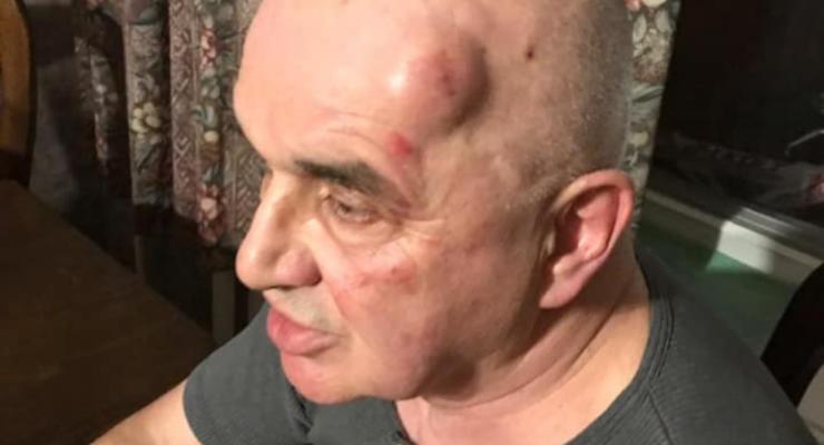 В Запорожье покушались на антимайдановца: Он отстреливался от нападавших