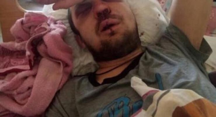 В Киеве неадекватный водитель маршрутки избил пассажира за сдачу