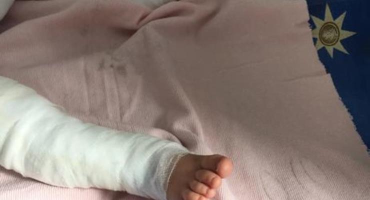 В Одесской области младенец упал в ведро с кипятком