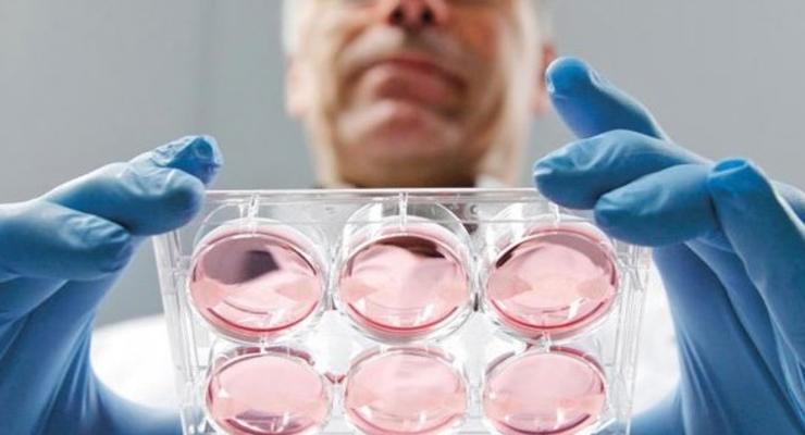 В Нидерландах врач подменял сперму, став отцом 49 детей