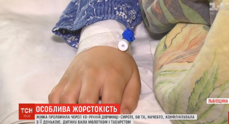 Проломила череп молотком: детали жестокого избиения ребенка под Львовом