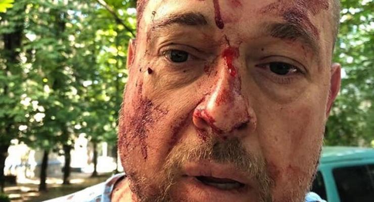 Кастетами по голове: В Харькове до крови избили активиста