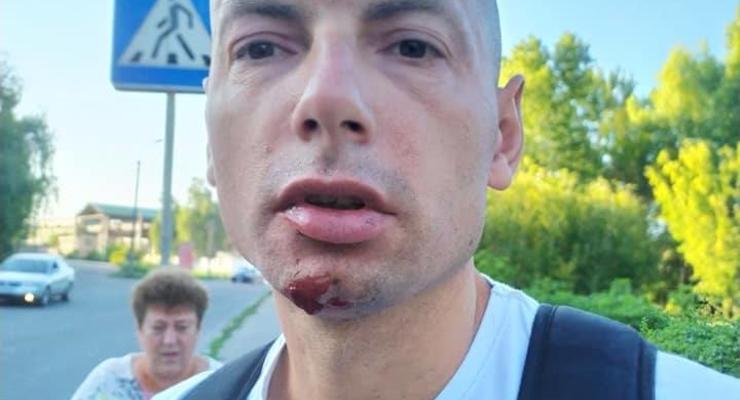 В Чернигове избили известного местного журналиста