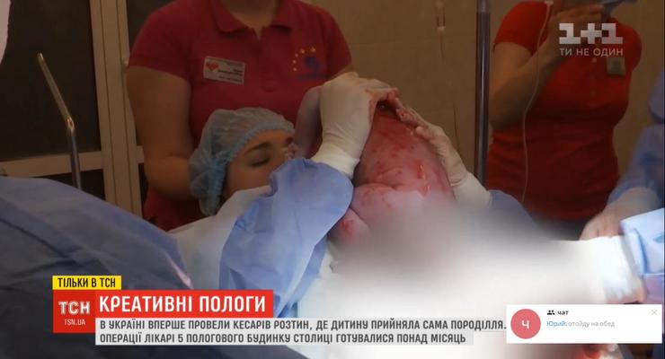 Уникальные роды: В Киеве роженица ассистировала врачам