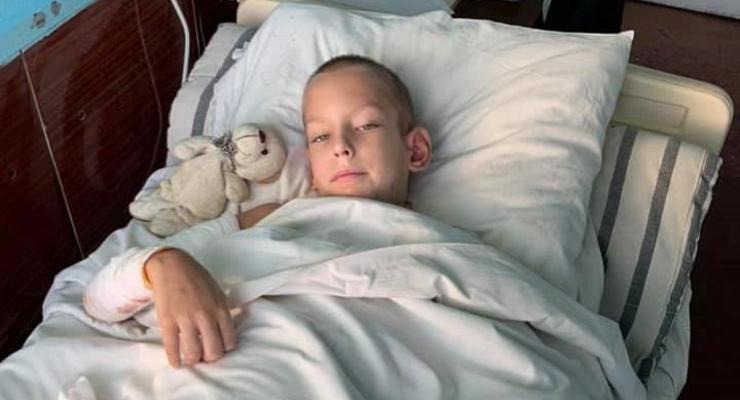 В Днепре дети подожгли мальчика: Врачи борются за жизнь 8-летнего Кирилла