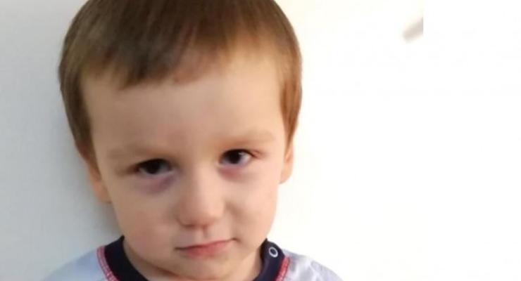 В Киеве полиция разыскивает родителей избитого 3-летнего мальчика