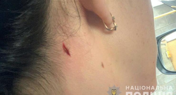 В Николаеве женщина пострадала во время полицейских стрельб