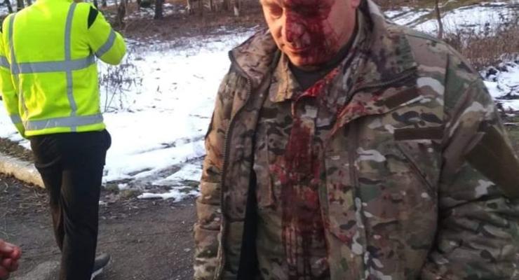 Молотком по голове: Под Тернополем жестоко избили ветерана АТО
