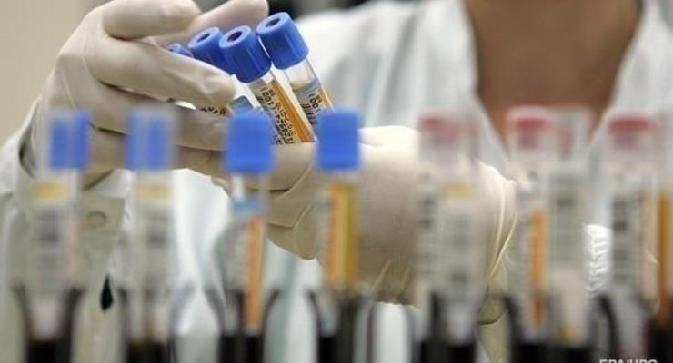 В Украине появятся тест-системы для диагностики коронавируса