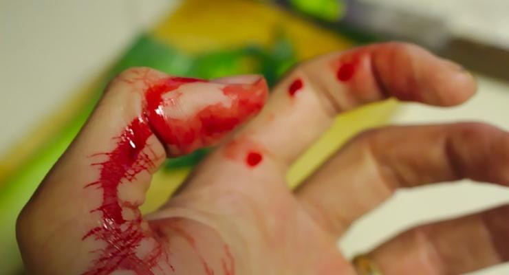 На Сумщине 13-летняя девочка ударила мать ножом из-за запрета пойти погулять