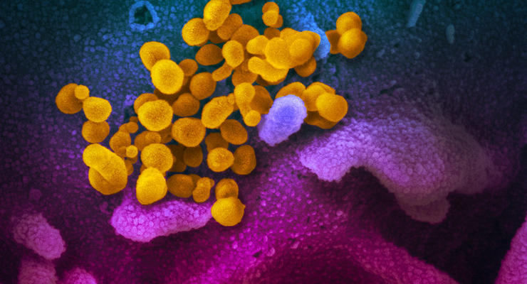 Стало известно, как выглядит коронавирус под микроскопом