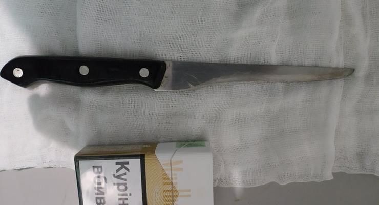 Под Запорожьем в пищеводе пациента нашли нож