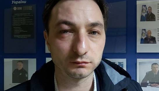 В Киеве напали на главврача Института рака