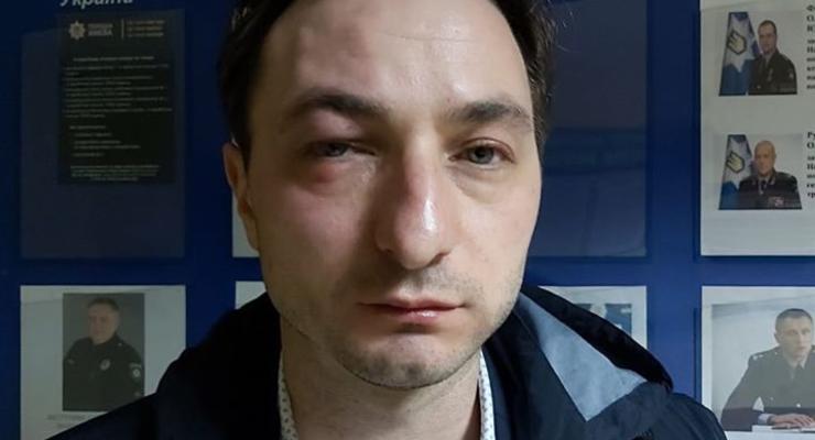 В Киеве напали на главврача Института рака