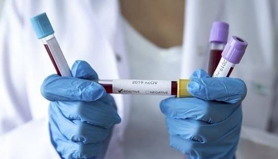 Описаны симптомы первой жертвы Covid-19 в Украине