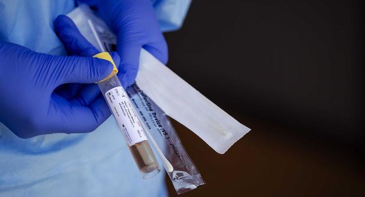 Экспресс-тесты выявили коронавирус у 57 человек в Ивано-Франковске