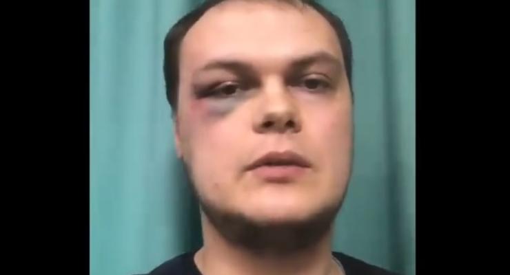 В Харькове избили журналиста, снимавшего нарушение карантина