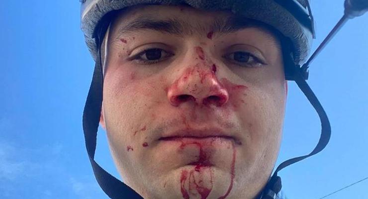 В Киеве избили велосипедиста, помешавшего машине проехать по тротуару