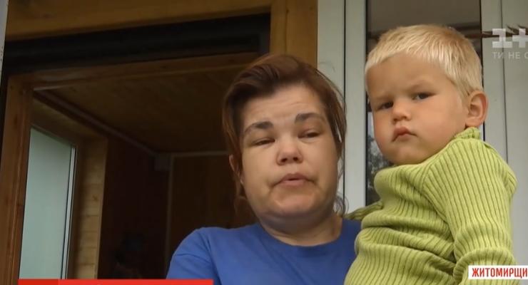 В Житомирской области многодетная мать чудом вижила после удара молнии
