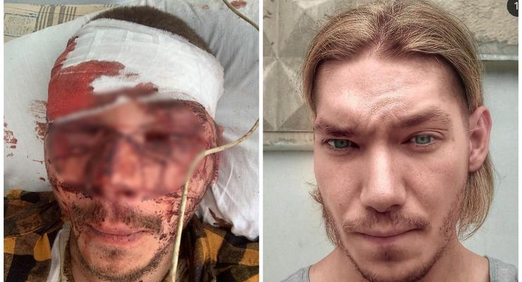 В Харькове жестоко избили активиста "Партии Шария": Он в реанимации