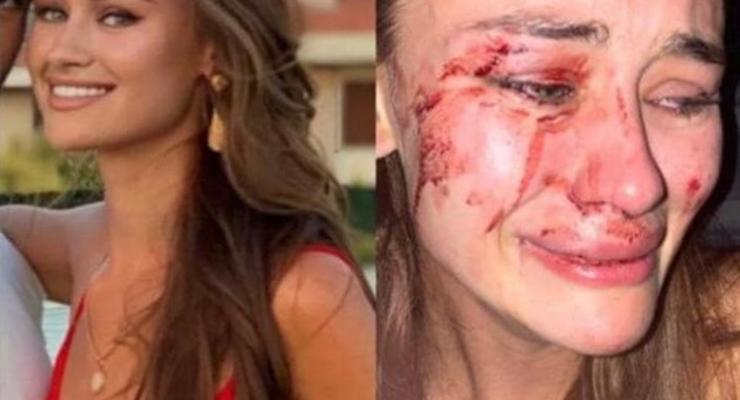 Появилось видео избиения украинской модели в Турции