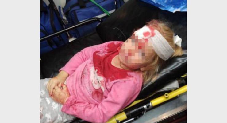 Протесты в Беларуси: в Гродно пострадала пятилетняя девочка