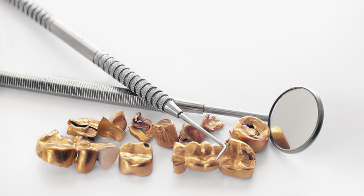 На Ровенщине стоматолог украл золото для зубных протезов и уволился