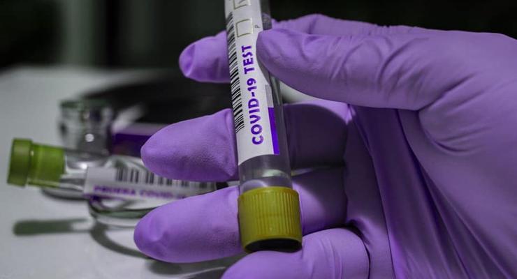 В Украине выявили 2 141 новый случай коронавируса